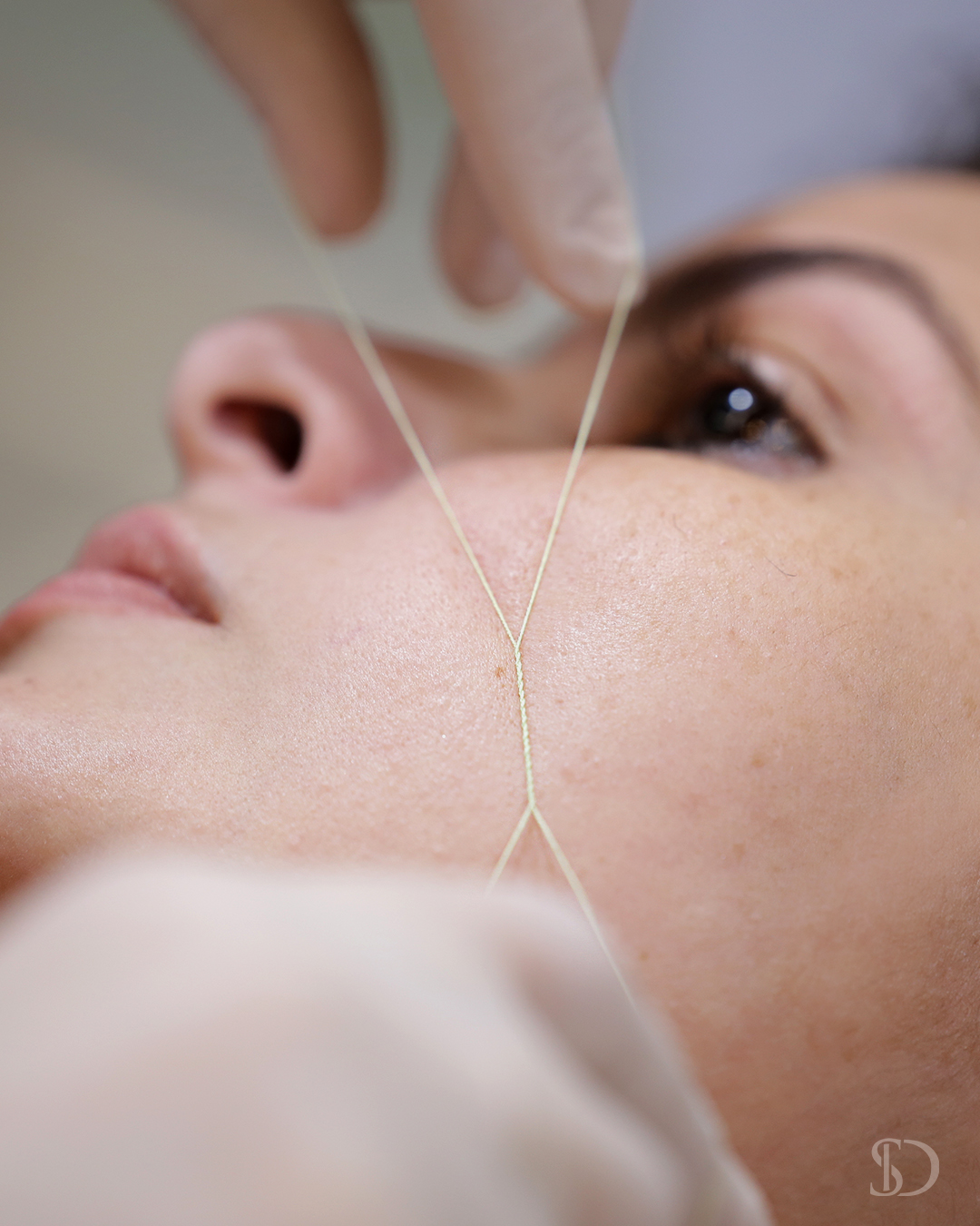 remoção de pelos com linha